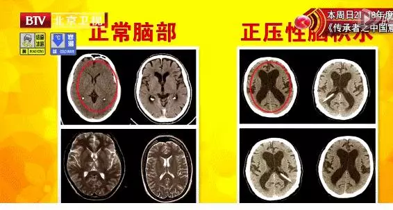 「健康」身體好不好,看你走路的姿勢就知道!一定要小心