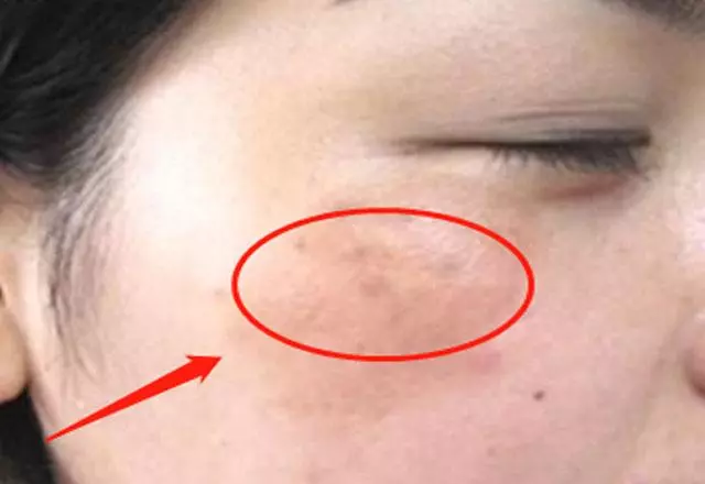 女人子宮舒服,臉上有3個好表現,常吃1樣菜,有益於養護子宮
