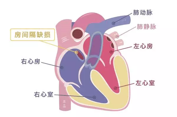 一旦手上有這3個信號,說明「心臟」危險了,這三件事一定少做!