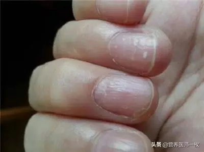 一旦手上有這3個信號,說明「心臟」危險了,這三件事一定少做!