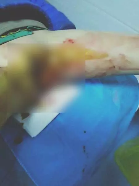 變態老師令2男生罰女孩 藤鞭插下體 失生育能力