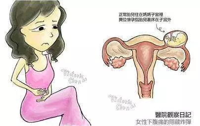 女性身體出現這5種情況 說明子宮不好了