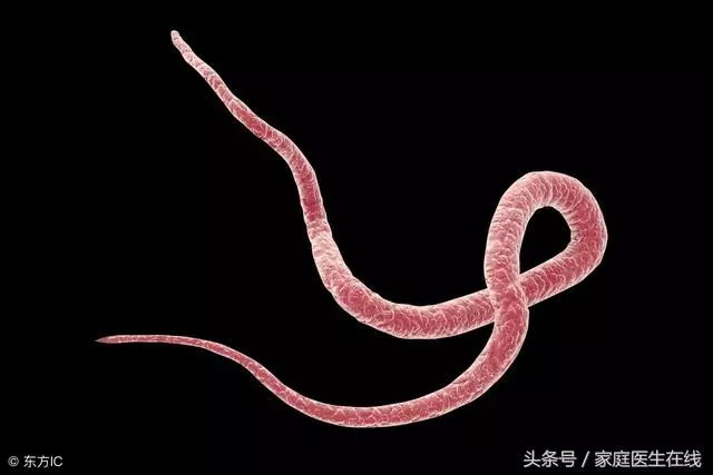怎麼知道肚子裡有沒有蛔蟲?醫生:可試試這3種簡單辨別方法,準確率99.9%!