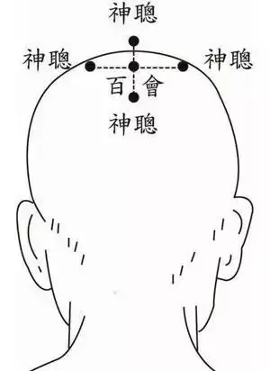 拍百會、跺腳法、揉臍法,捏脊法,零成本治病痛!