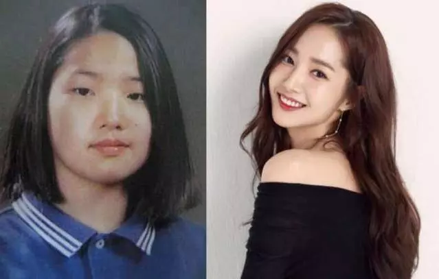 被說整容怪物,遭遇霸凌導致憂鬱13年,韓國女星的出道歷程!
