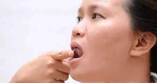 口臭自己聞不到?3個自檢小方法,1種茶,輕鬆去口臭