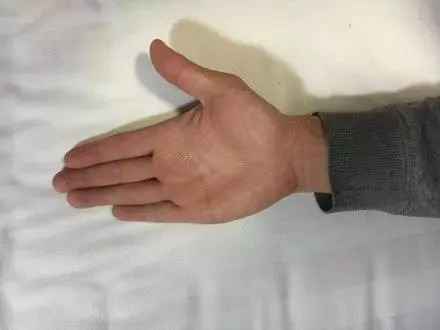 老年人皮膚瘙癢不用愁,按一穴炙一穴,皮膚不癢,精神也好了