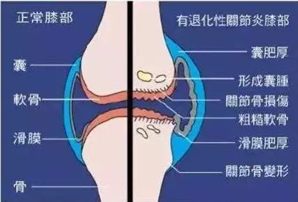 灸這4個穴位,趕走老寒腿,和下肢冰涼說再見!