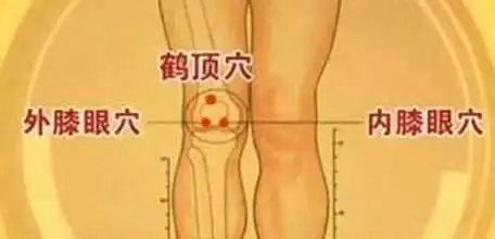 灸這4個穴位,趕走老寒腿,和下肢冰涼說再見!