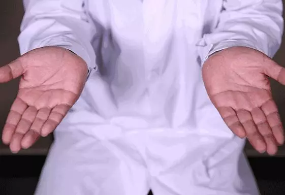 每天握拳100下,體內經絡通了,氣血足了,防止骨退化、預防近視及老花眼,身體越來越健康