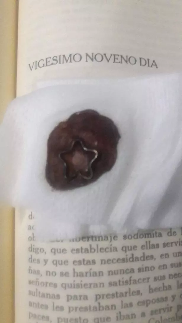 天上的星星摘不到 狂妹「摘下自己的肚臍」放封口袋:這比我的心還珍貴