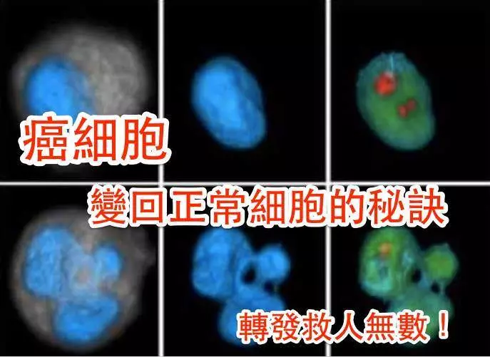 1 年內治好癌症!讓癌細胞「變回」正常細胞的秘訣!
