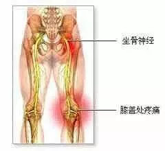 腰椎疼痛需要了解的穴位圖!你值得收藏!