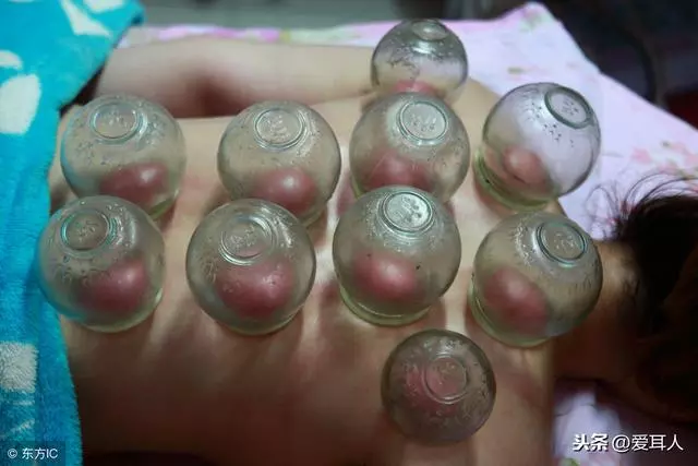 「耳穴+艾灸」花錢少=減肥成功
