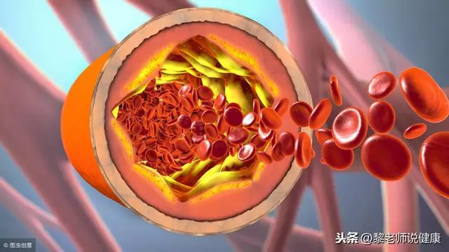 耳鳴、耳朵嗡嗡作響,眩暈怎麼破?4個食療方,遠離耳鳴、眩暈!