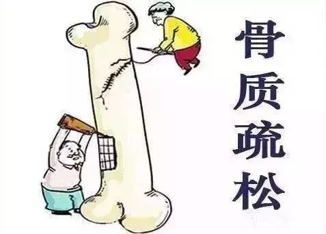 骨質疏鬆不用花大錢買保健品! 只要做好3件事 , 50歲擁有18歲的骨骼 !