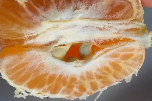 橘子上的白絲能去火?它到底是什麼?