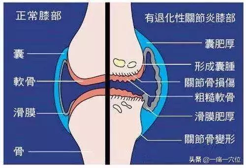老人學會預防為關鍵,每天掐掐此穴,可預防心臟疾病與膝關節痛!