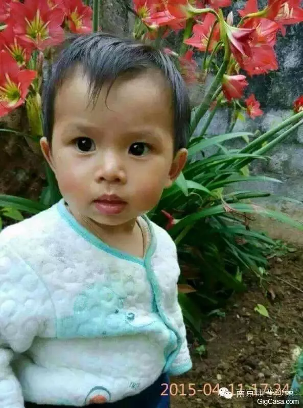 1歲小孩的臉被燙傷,一種「神奇的植物果實」救了孩子!知道了一定要分享!