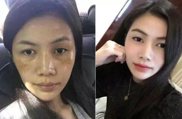 半根黃瓜祛斑法,36歲大姐5天淡斑,一周蛻變水潤豆腐肌!