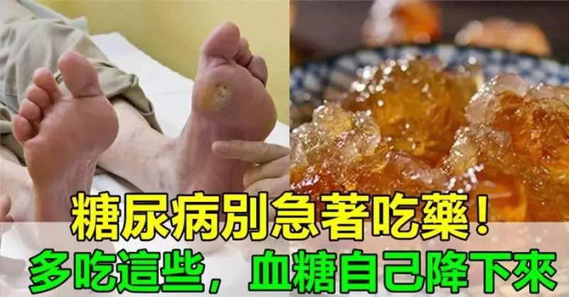 糖尿病人別急著吃藥,每天多吃這些食物,3個月,血糖自己慢慢降下來