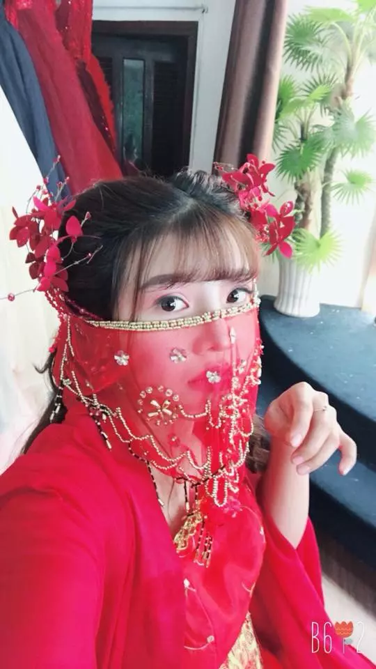迷唇姐花42萬整成野甜妹 只是狠狠摔一跤「像跌近照妖鏡」打回大媽原形!