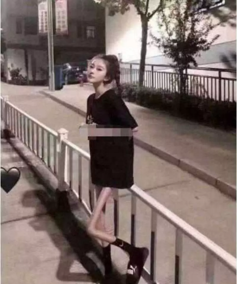 甜美網紅最令人作噁的真相 鏡頭帶到PS後的腿「差點以為竹筷子插在肉身上」