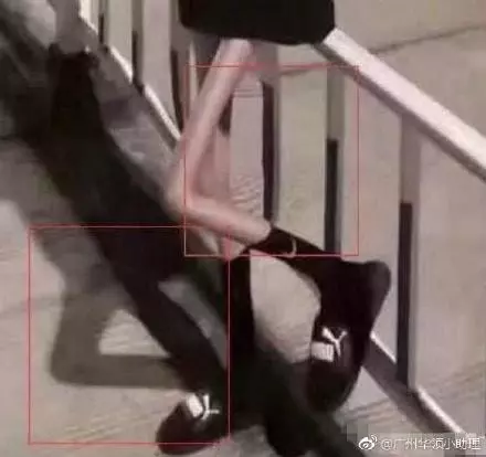 甜美網紅最令人作噁的真相 鏡頭帶到PS後的腿「差點以為竹筷子插在肉身上」