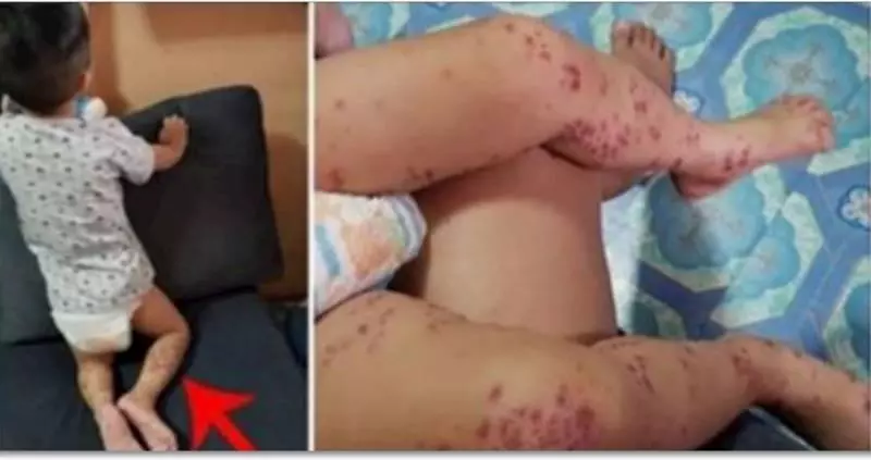 兒子從賣場回家「皮膚紅腫潰爛」!醫生檢查嘆「沒藥可醫」媽媽痛心呼籲:所有家長都要注意