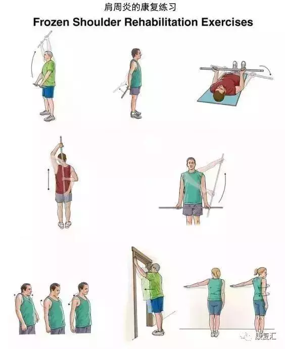 全身各部位常見疼痛康復訓練圖解(頸、肩、腰、背、腹部)