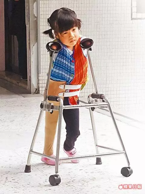 5歲單腳天使笑容催淚!四肢剩左腿「盼上學沒人說奇怪」 「與父相依為命」賣米線淚謝暖心客