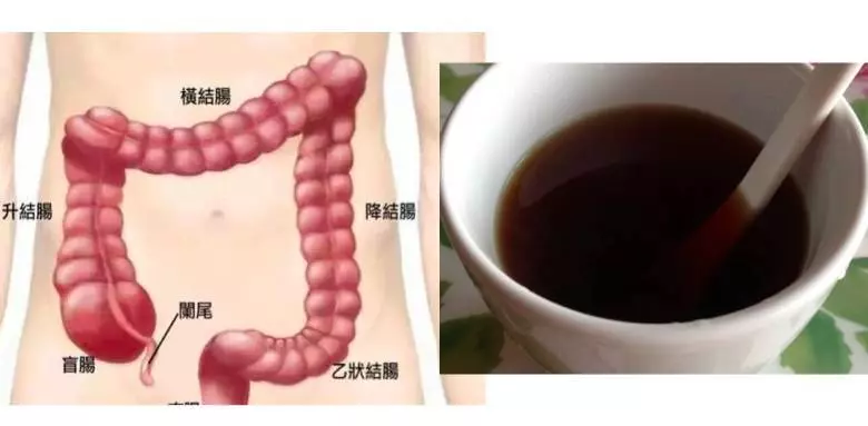 放屁很臭的人是因為體內大便太毒了!每天喝 1 杯「清腸」,以後放屁不臭、大便也順暢了!