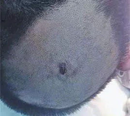 女兒頭痛險沒命!老師撥開頭髮發現「髮尖在動」,愣住 園長看了1眼馬上送醫:差點保不住 !