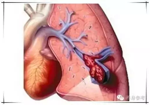 按摩一個地方,一輩子不會「心肌梗塞」為家人收藏好!轉一次,救一人!!