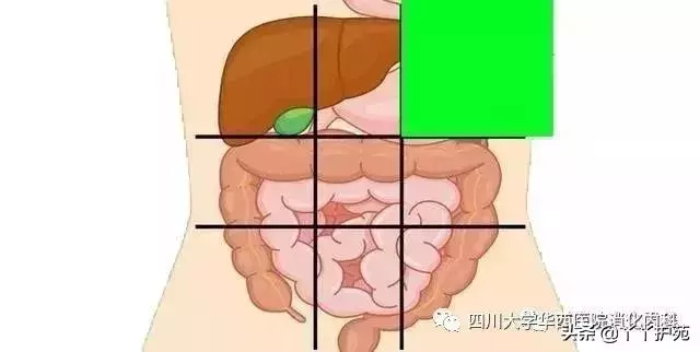 一張腹部地圖,了解腹痛