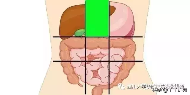一張腹部地圖,了解腹痛