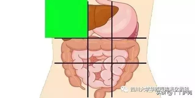 一張腹部地圖,了解腹痛