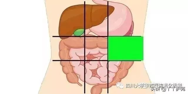 一張腹部地圖,了解腹痛