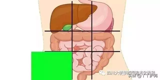 一張腹部地圖,了解腹痛