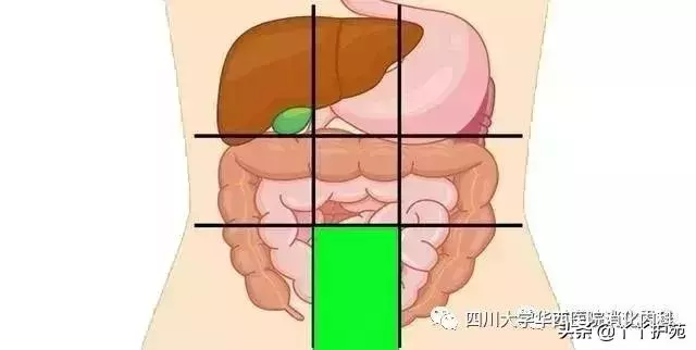 一張腹部地圖,了解腹痛