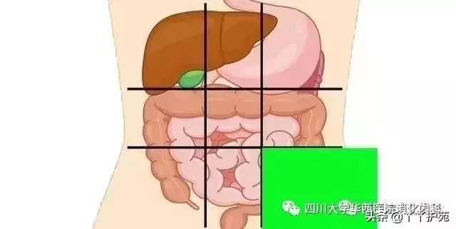 一張腹部地圖,了解腹痛