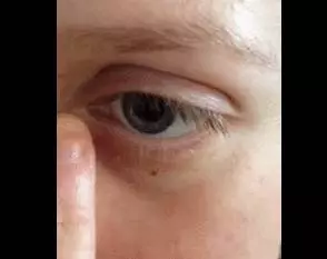 22張會讓你頭皮發麻到「以為自己3天沒洗頭」的驚悚圖片,你能夠全部看完嗎?
