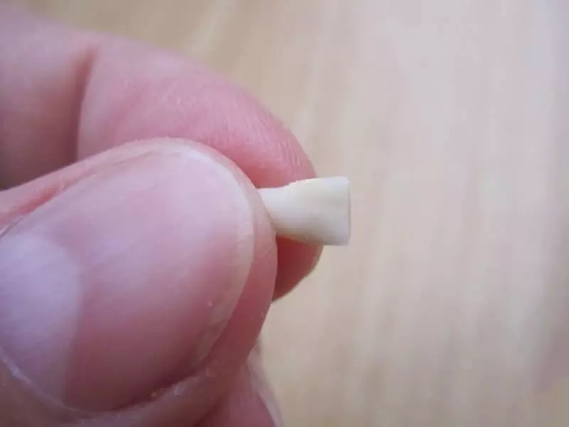 別再把「小孩掉落的乳牙」扔掉了!最新研究證明:關鍵時刻可救自己一命!