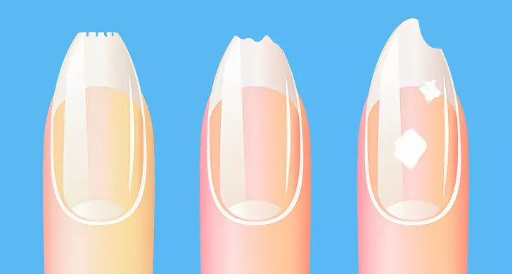 10種症狀告訴你「身體警鈴正在響」 牙齒上的白點還有分級數!