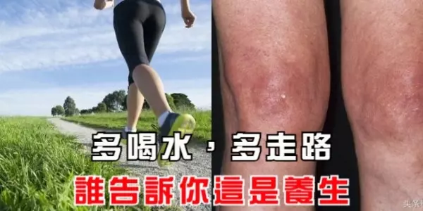 多喝水,多走路,誰告訴你這是養生,小心這些要命的養生法!