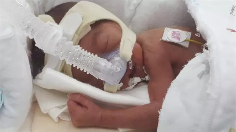 大馬醫生夫妻游日本早產生女,被95萬令吉醫藥費愁哭!小Akira想要活下去
