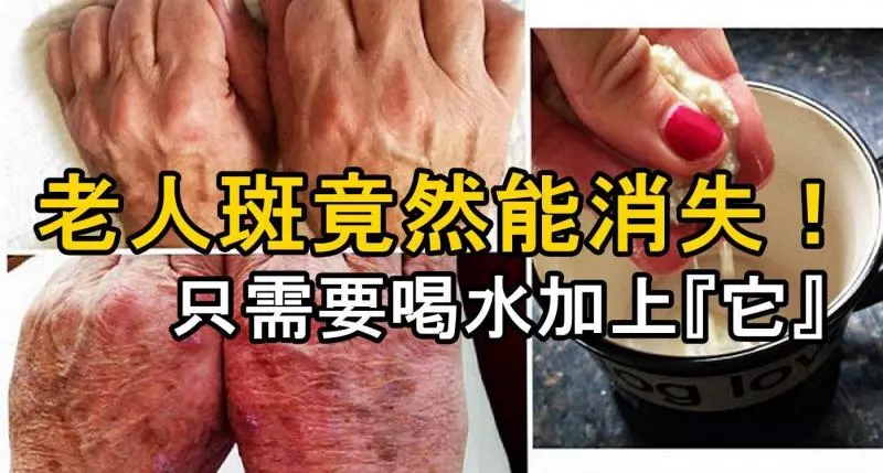 老人斑竟然能消失!只需要喝水加上…簡單製作又好喝!