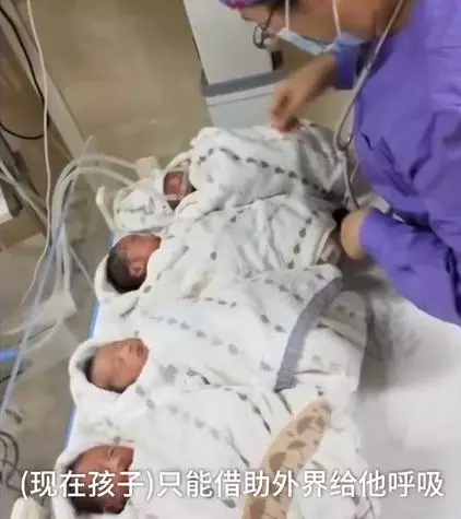 70萬分之一的幸運!媽媽產下「罕見龍鳳四胞胎」 一次湊到「兩個好」爸暖喊: 生活再難也不願放棄 !