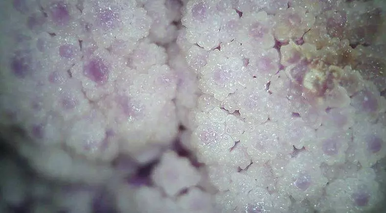 19張日常物品在「顯微鏡底下」的奇妙模樣 眉毛放大後太噁!