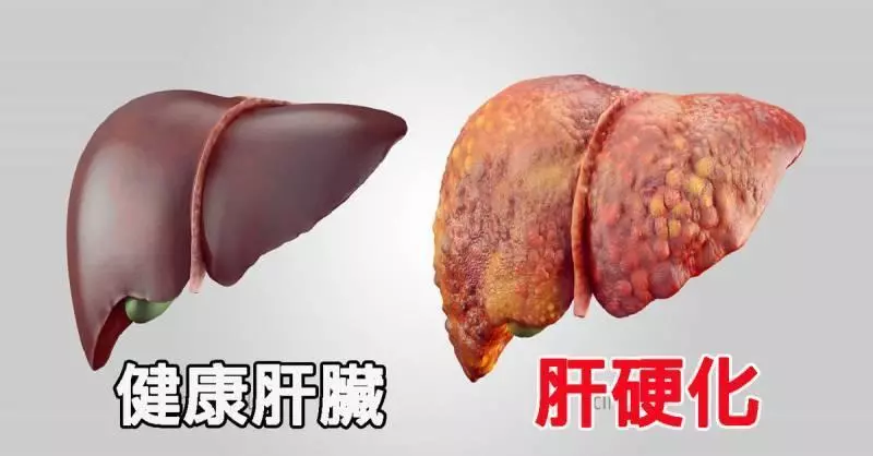 馬鈴薯+紅蘿蔔+蘋果 打成汁來喝 竟然有那麼多功效